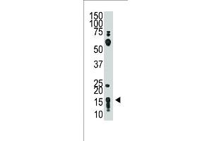 The anti-THY1 (N-term) Pab (ABIN388803 and ABIN2839126) is used in Western blot to detect THY1 in HL60 cell lysate. (CD90 antibody  (N-Term))