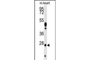 Western blot analysis of anti-WDYHV1 Antibody Pab in mouse heart tissue lysates (35ug/lane). (WDYHV1 antibody  (AA 106-136))