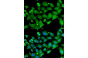 Immunofluorescence analysis of MCF-7 cells using RBBP7 antibody.