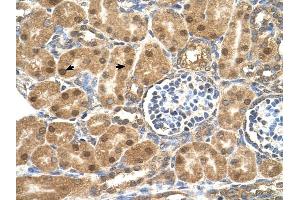 PTGDS antibody was used for immunohistochemistry at a concentration of 4-8 ug/ml to stain Epithelial cells of renal tubule (arrows) in Human Kidney. (PTGDS antibody)