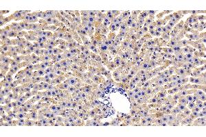 Detection of OSMR in Rat Liver Tissue using Polyclonal Antibody to Oncostatin M Receptor (OSMR) (Oncostatin M Receptor antibody  (AA 503-749))