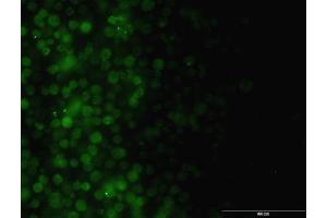 Immunofluorescence of monoclonal antibody to ILK on Jurkat cell.