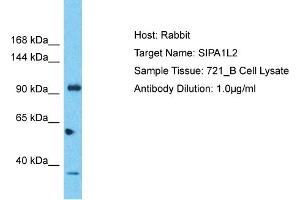 Host: Rabbit Target Name: SIPA1L2 Sample Tissue: Human 721_B Whole Cell Antibody Dilution: 1ug/ml (SIPA1L2 antibody  (C-Term))