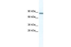 WB Suggested Anti-GATAD2A Antibody Titration:  2. (GATAD2A antibody  (N-Term))