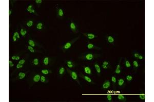 Immunofluorescence of monoclonal antibody to AKAP8 on HeLa cell. (AKAP8 antibody  (AA 551-662))