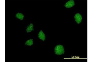 Immunofluorescence of purified MaxPab antibody to C21orf7 on HeLa cell. (MAP3K7CL antibody  (AA 1-242))