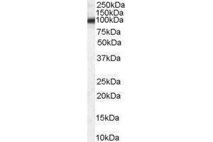 ABIN2562910 (0. (Purinergic Receptor P2Y, G-Protein Coupled, 13 (P2RY13) (Internal Region) antibody)
