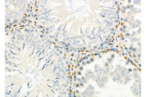 ABIN6262224 and ABIN6266867 at 1/100 staining Rat testis tissue by IHC-P. (HEXIM1 antibody  (C-Term))