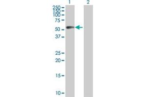 Lane 1: CCNB1 transfected lysate ( 48. (CCNB1 293T Cell Transient Overexpression Lysate(Denatured))