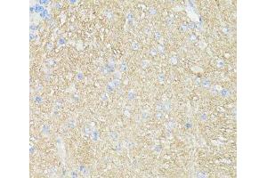 Immunohistochemistry of paraffin-embedded Mouse brain using THY1 Polyclonal Antibody at dilution of 1:100 (40x lens). (CD90 antibody)