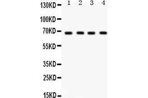 Western Blotting (WB) image for anti-G Protein-Coupled Receptor Kinase 5 (GRK5) (AA 393-429), (C-Term) antibody (ABIN3042434) (GRK5 antibody  (C-Term))