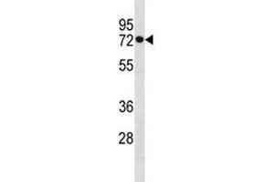HSPA1L antibody western blot analysis in MDA-MB453 lysate. (HSPA1L antibody  (AA 576-603))