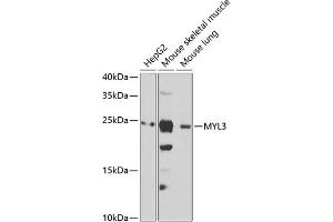 Western blot analysis of extracts of various cell lines, using MYL3 antibody (ABIN6133198, ABIN6144249, ABIN6144250 and ABIN6222363) at 1:1000 dilution. (MYL3/CMLC1 antibody  (AA 1-195))