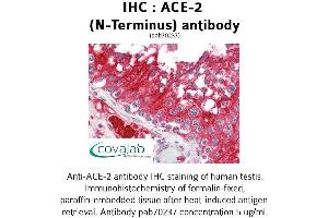 Image no. 2 for anti-Angiotensin I Converting Enzyme 2 (ACE2) antibody (ABIN1731444) (ACE2 antibody)
