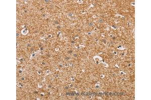 Immunohistochemistry of Human brain  using CYP4A11 Polyclonal Antibody at dilution of 1:30 (CYP4A11 antibody)