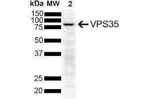 Western Blot analysis of Human SH-SY5Y showing detection of VPS35 protein using Mouse Anti-VPS35 Monoclonal Antibody, Clone 11H10 (ABIN6933004).