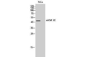Western Blotting (WB) image for anti-Cholinergic Receptor, Muscarinic 2 (CHRM2) (Internal Region) antibody (ABIN3185429) (Muscarinic Acetylcholine Receptor M2 antibody  (Internal Region))