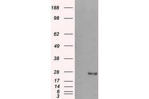 Western Blotting (WB) image for anti-Dicarbonyl/L-Xylulose Reductase (DCXR) antibody (ABIN1497784) (DCXR antibody)