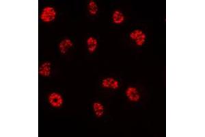 Immunofluorescent analysis of PE2 staining in HeLa cells. (ERF antibody  (C-Term))