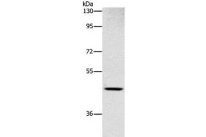 Western Blot analysis of Human placenta tissue using CD327 Polyclonal Antibody at dilution of 1:1000 (SIGLEC6 antibody)