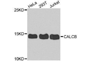 Western blot analysis of extract of various cells, using CALCB antibody. (CALCB antibody)