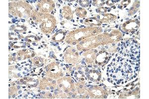 EXOSC7 antibody was used for immunohistochemistry at a concentration of 4-8 ug/ml to stain Epithelial cells of renal tubule (arrows) in Human Kidney.