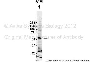Sample Type: 1. (Vimentin antibody  (C-Term))