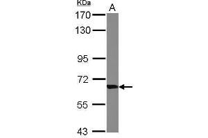 WB Image Sample (30 ug of whole cell lysate) A: Raji 7. (TKT antibody)