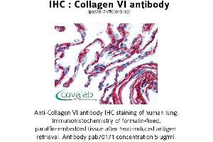 Image no. 1 for anti-Collagen, Type VI (COL6) antibody (ABIN1733229) (COL6 antibody)