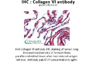 Image no. 1 for anti-Collagen, Type VI (COL6) antibody (ABIN1733229)