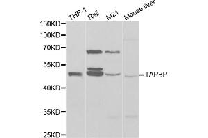 Western blot analysis of extracts of various cell lines, using TAPBP antibody (ABIN6293644) at 1:1000 dilution. (TAPBP antibody)