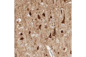 Immunohistochemical staining (Formalin-fixed paraffin-embedded sections) of human cerebral cortex with TNK1 polyclonal antibody  shows strong cytoplasmic positivity in neuronal cells at 1:20-1:50 dilution.