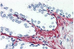 Anti-P2RX3 / P2X3 antibody  ABIN1049196 IHC staining of human prostate. (P2RX3 antibody  (C-Term))