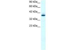 Western Blotting (WB) image for anti-GA-Binding Protein Subunit beta-2 (GABPB2) antibody (ABIN2463855)