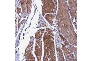 Immunohistochemical staining of human smooth muscle with YEATS2 polyclonal antibody  shows distinct cytoplasmic positivity.