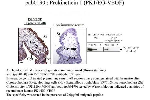 Prokineticin 1 抗体  (N-Term)