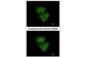 ICC/IF Image Immunofluorescence analysis of methanol-fixed A549, using ALPPL2, antibody at 1:500 dilution.