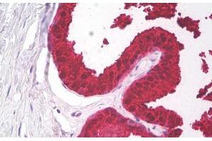 Image no. 2 for anti-Prostate Specific Antigen (PSA) antibody (ABIN1502668) (Prostate Specific Antigen antibody)