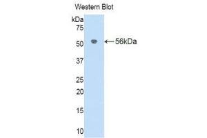 Western Blotting (WB) image for anti-Interleukin 18 Binding Protein (IL18BP) (AA 29-193) antibody (ABIN1176682) (IL18BP antibody  (AA 29-193))