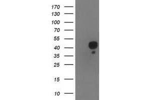 HEK293T cells were transfected with the pCMV6-ENTRY control (Left lane) or pCMV6-ENTRY NDEL1 (Right lane) cDNA for 48 hrs and lysed. (NDEL1 antibody)