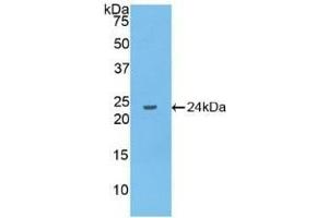 Detection of Recombinant IL10, Human using Polyclonal Antibody to Interleukin 10 (IL10) (IL-10 antibody  (AA 1-178))