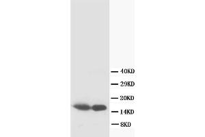 Western Blotting (WB) image for anti-S100 Calcium Binding Protein B (S100B) antibody (ABIN1108929) (S100B antibody)