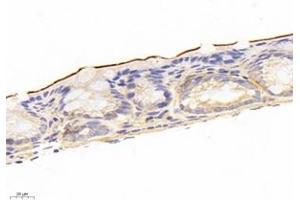 Immunohistochemistry analysis of paraffin-embedded mouse colon using,NHE-3 (ABIN7075685) at dilution of 1: 1200 (SLC9A3 antibody)