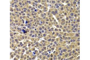 Immunohistochemistry of paraffin-embedded Mouse lung cancer using ARID3A Polyclonal Antibody at dilution of 1:100 (40x lens). (ARID3A antibody)