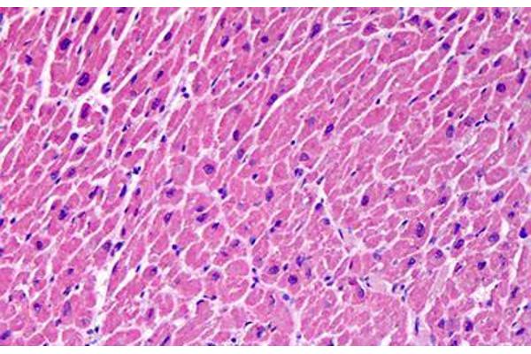 Syntaxin 18 antibody  (AA 101-200)