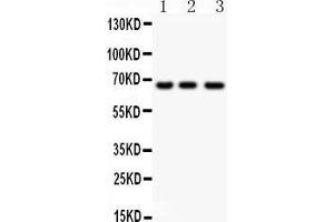 Observed bind size: 64KD (NF-kB p65 antibody  (AA 99-551))