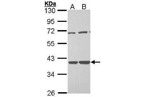 WB Image Sample (30 ug of whole cell lysate) A: H1299 B: Hela 10% SDS PAGE antibody diluted at 1:1000