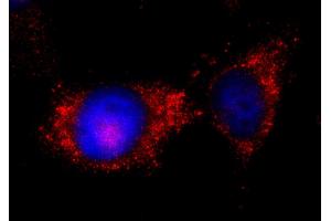 Immunofluorescence (IF) image for anti-Integrin-Linked Kinase (ILK) (AA 402-451) antibody (ABIN7453381)
