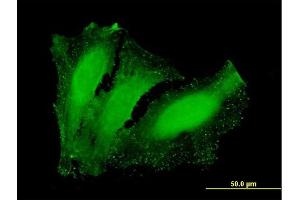 Immunofluorescence of purified MaxPab antibody to NETO2 on HeLa cell. (NETO2 antibody  (AA 1-148))