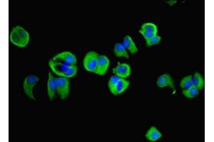 Immunofluorescent analysis of MCF-7 cells using ABIN7143935 at dilution of 1:100 and Alexa Fluor 488-congugated AffiniPure Goat Anti-Rabbit IgG(H+L) (NAPA antibody  (AA 1-295))